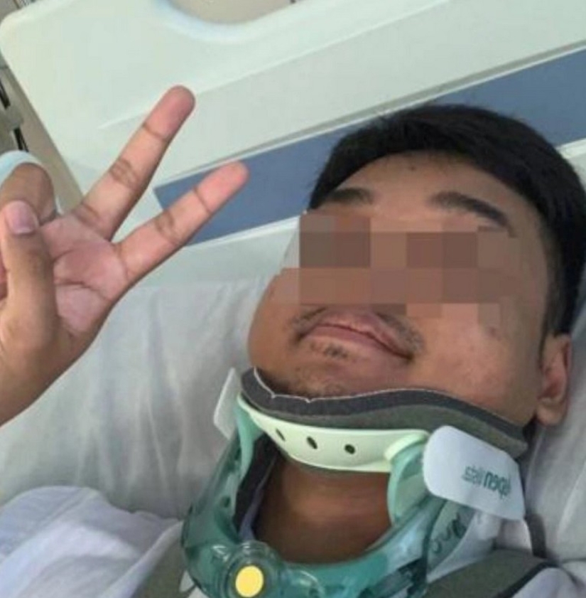 Smartwatch saved the owner's life after a serious accident on a deserted highway