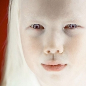 Snow White from Yakutia - an 8-year-old girl with a rare appearance conquered the Internet