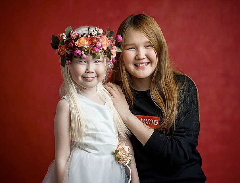 Snow White from Yakutia - an 8-year-old girl with a rare appearance conquered the Internet Snow White from Yakutia - an 8-year-old girl with a rare appearance conquered the Internet