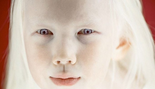 Snow White from Yakutia - an 8-year-old girl with a rare appearance conquered the Internet Snow White from Yakutia - an 8-year-old girl with a rare appearance conquered the Internet