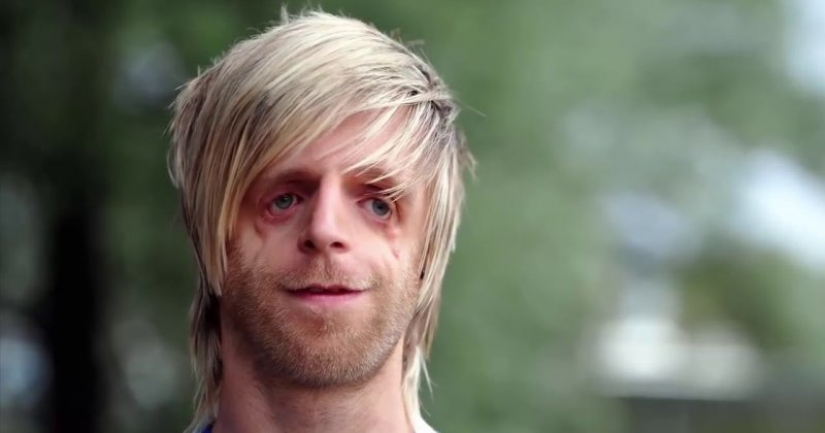 Su madre se asustó y lo dejó en el hospital, pero creció y se convirtió en un éxito