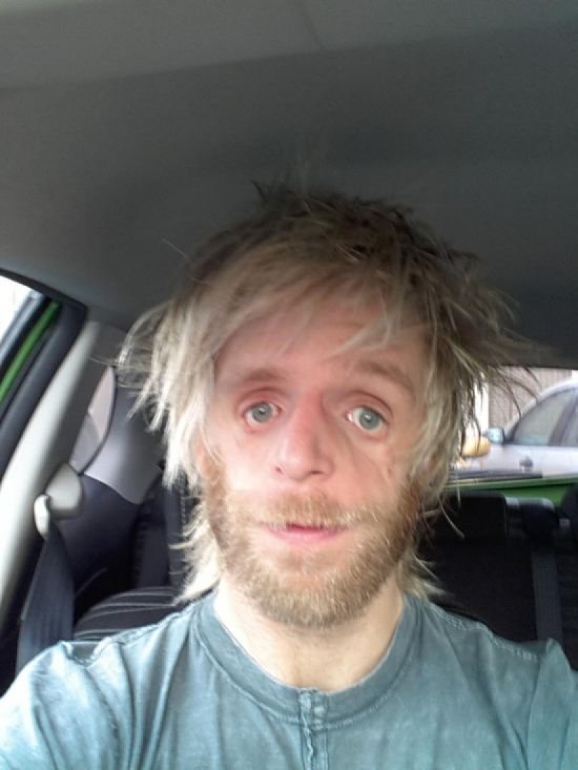 Su madre se asustó y lo dejó en el hospital, pero creció y se convirtió en un éxito