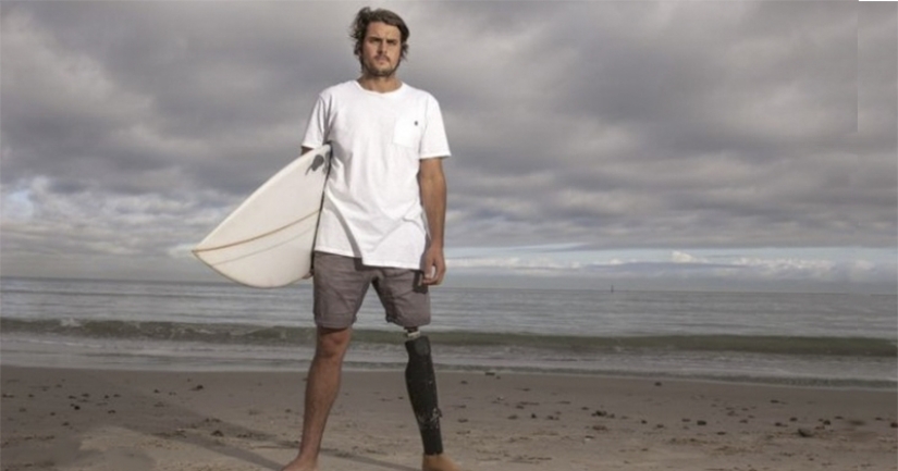 Surfista demanda estado por diente de tiburón que mordió su pierna Surfista demanda estado por diente de tiburón que mordió su pierna