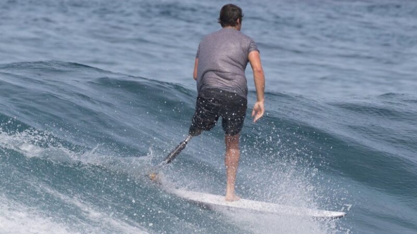 Surfista demanda estado por diente de tiburón que mordió su pierna Surfista demanda estado por diente de tiburón que mordió su pierna