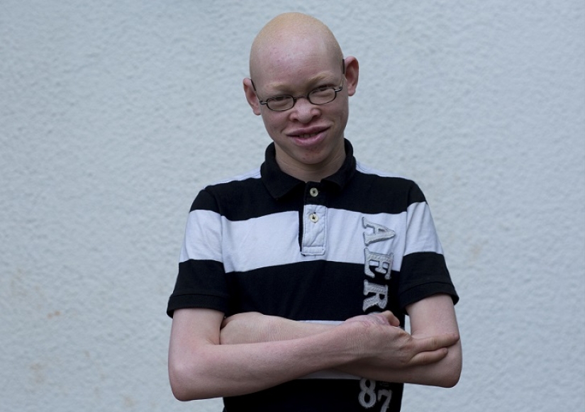 Tanzanian albinos, whose bodies are worth more than gold