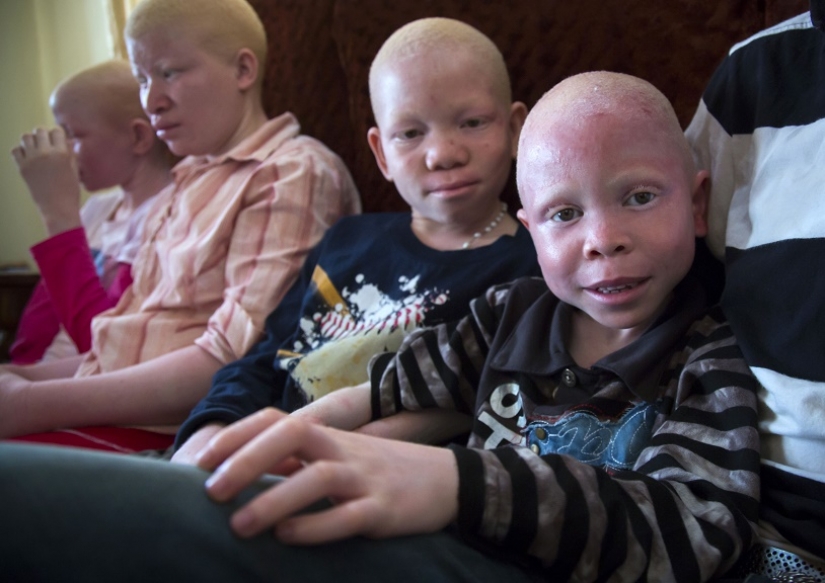 Tanzanian albinos, whose bodies are worth more than gold