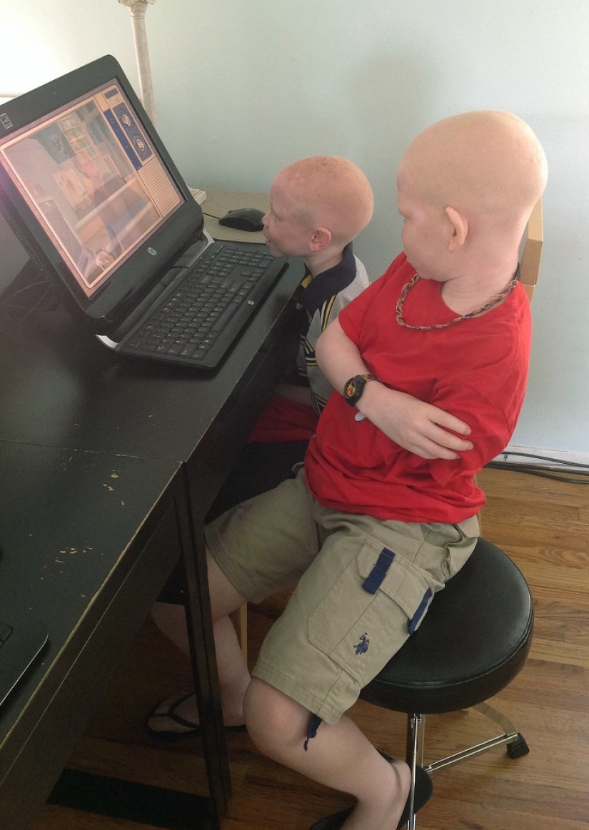 Tanzanian albinos, whose bodies are worth more than gold