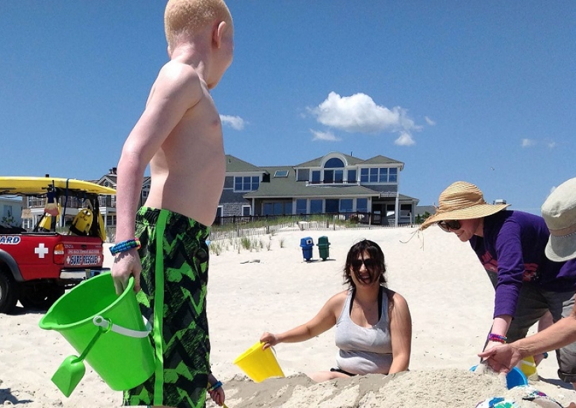 Tanzanian albinos, whose bodies are worth more than gold