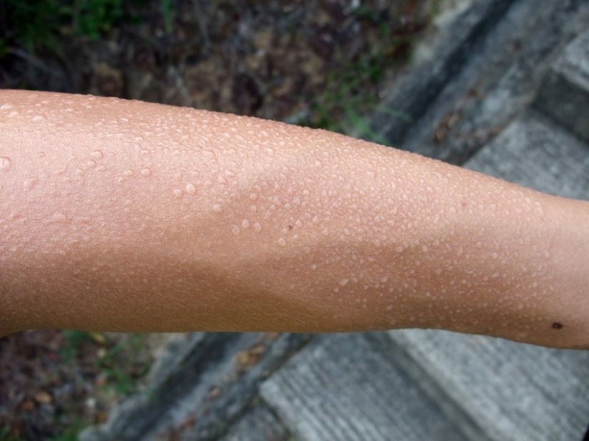 The 25 strangest diseases in the world that scientists still can't explain The 25 strangest diseases in the world that scientists still can't explain