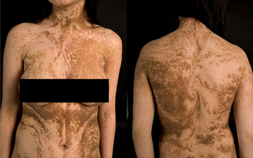 The 25 strangest diseases in the world that scientists still can't explain The 25 strangest diseases in the world that scientists still can't explain