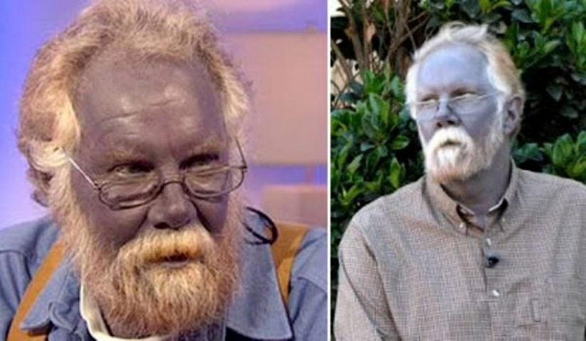 The 25 strangest diseases in the world that scientists still can't explain The 25 strangest diseases in the world that scientists still can't explain