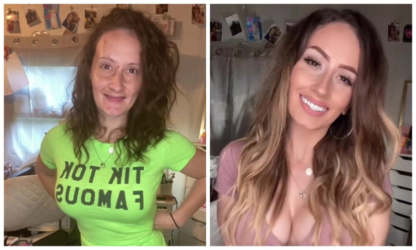 The American lost all her teeth at the age of 21, but remained confident, thanks to her husband