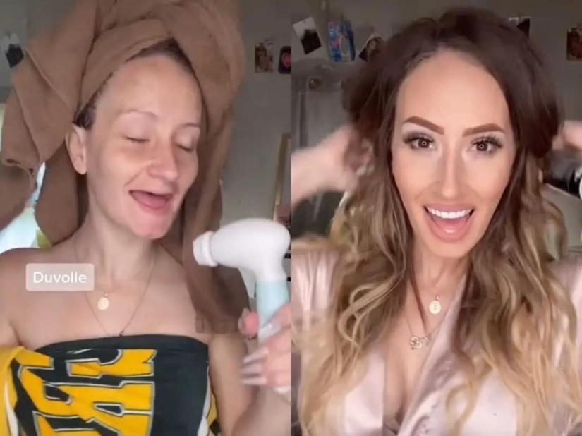 The American lost all her teeth at the age of 21, but remained confident, thanks to her husband