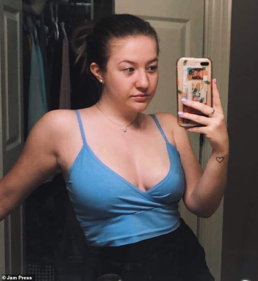 The American woman paid 700 thousand for breast reduction, but the bust grew again