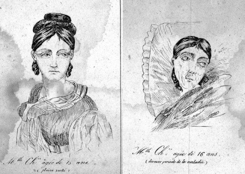 The cure for all diseases: female circumcision in Victorian England
