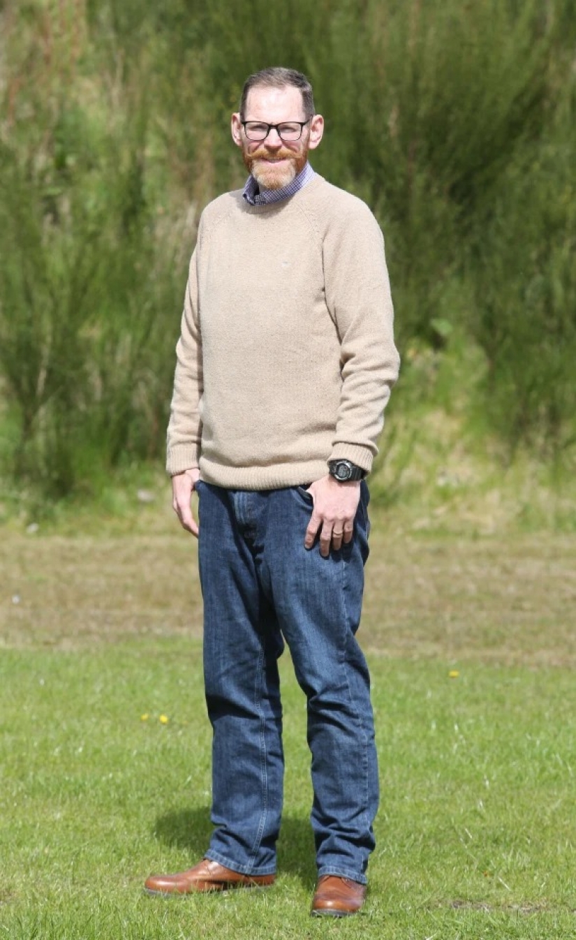 The fattest Briton lost 270 kg because he was afraid to crush his wife in bed