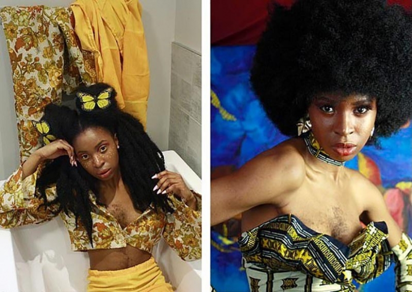 The girl with hair on his chest took myself for who I am and happy