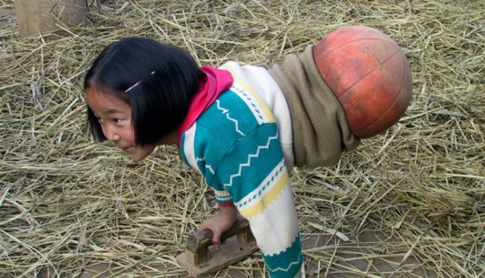 The national heroine of China: a girl with a basketball instead of legs became a famous athlete