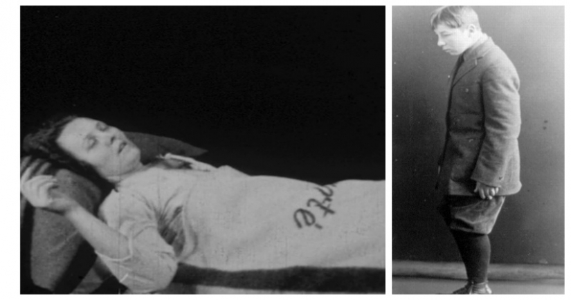 The Sleeping Sickness Epidemic: a strange disease that turned people into living zombies The Sleeping Sickness Epidemic: a strange disease that turned people into living zombies