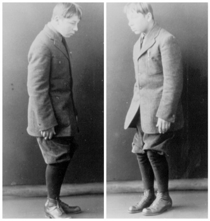 The Sleeping Sickness Epidemic: a strange disease that turned people into living zombies The Sleeping Sickness Epidemic: a strange disease that turned people into living zombies