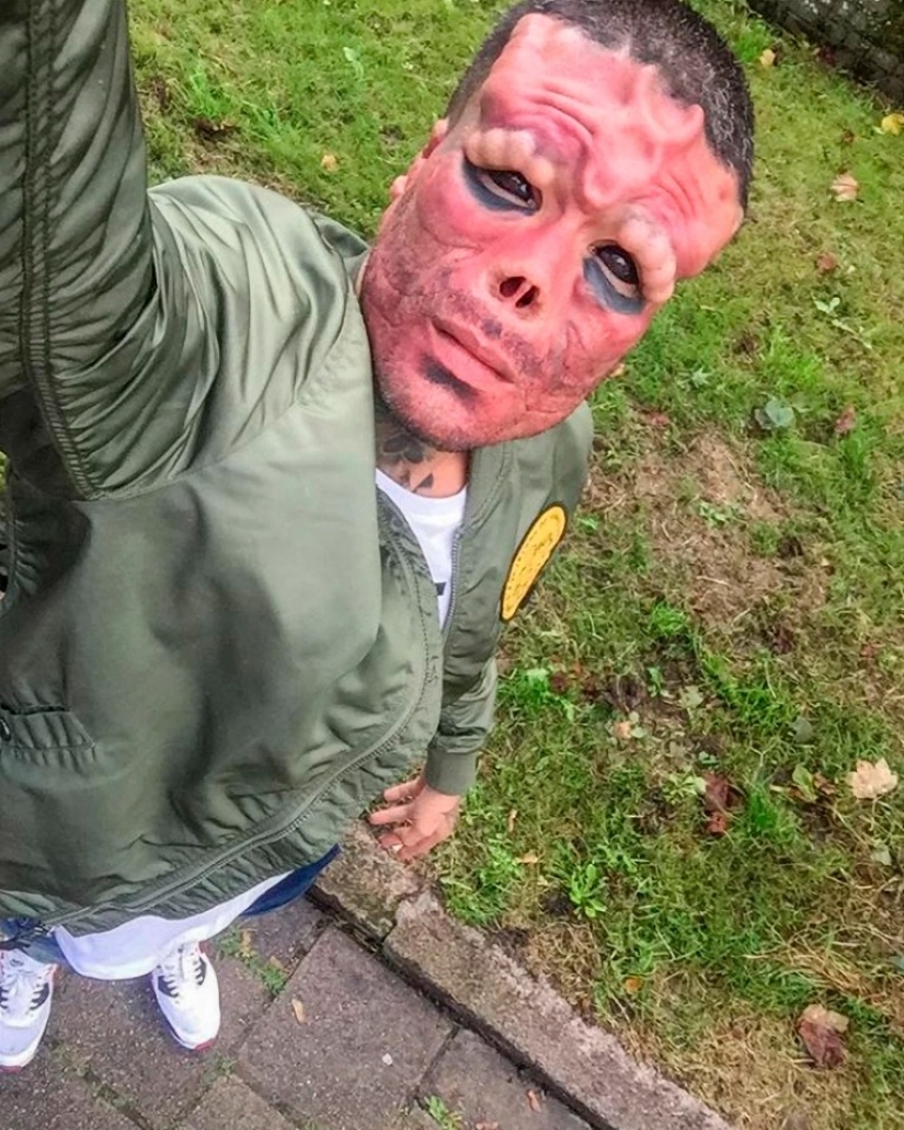 The Spaniard cut off his nose and made horns to look like the Red Skull from "The Avengers"