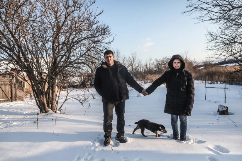 The story of Ani boldyrevoy, which has lost face because of the fire, but hopes for a better life