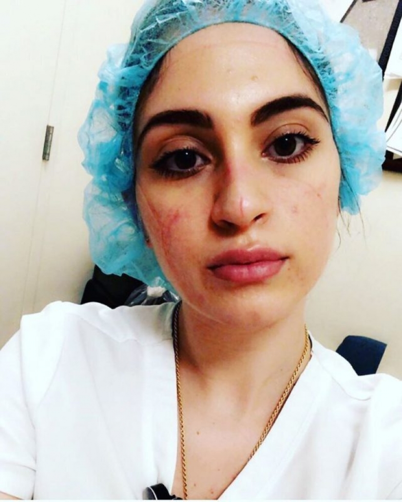 "These wounds will not go away — they will remain inside us": photos of medical girls with traces of masks on their faces