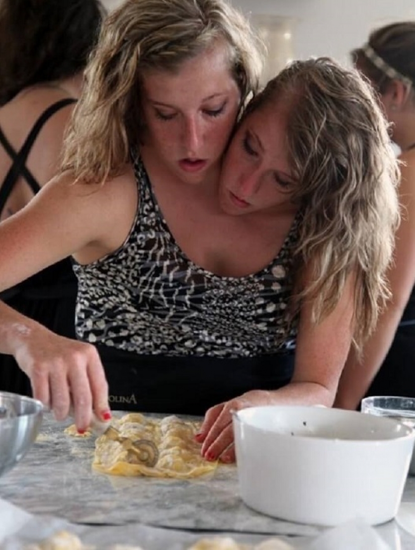 Un cuerpo para dos: ¿cómo viven las gemelas siamesas Abigail y Brittany Hensel?