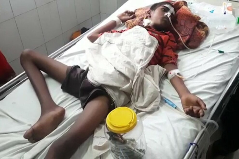 Un joven indio comía cepillos de dientes y uñas para curar la adicción