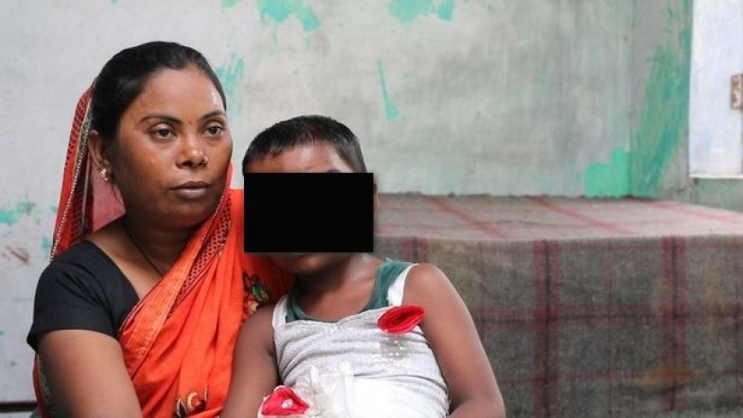 Una niña con dos narices en la India es considerada la encarnación de una deidad Una niña con dos narices en la India es considerada la encarnación de una deidad