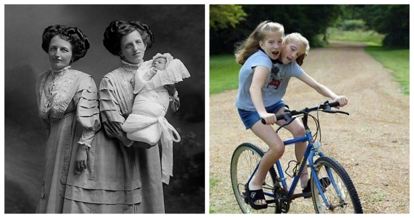 Una vida para dos personas sin tensión y tragedias: una feliz gemelos Siameses Una vida para dos personas sin tensión y tragedias: una feliz gemelos Siameses