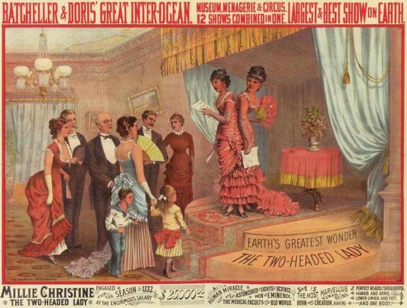 Una vida para dos personas sin tensión y tragedias: una feliz gemelos Siameses Una vida para dos personas sin tensión y tragedias: una feliz gemelos Siameses