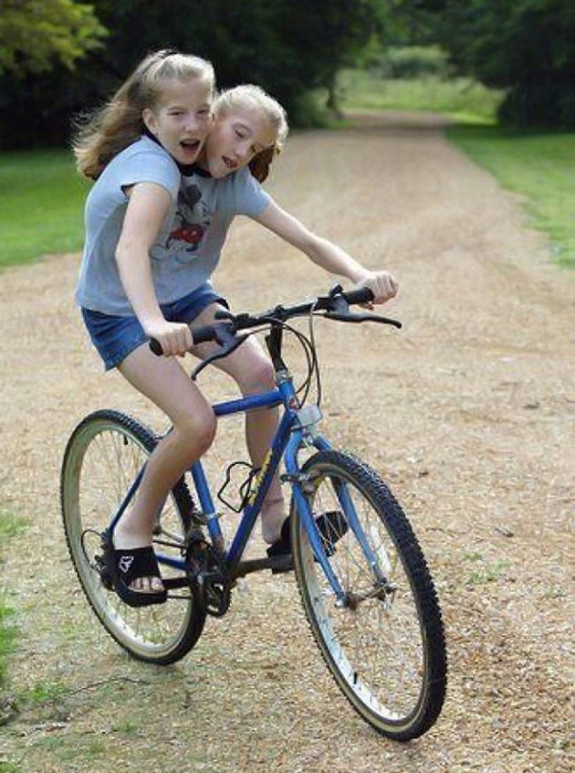 Una vida para dos personas sin tensión y tragedias: una feliz gemelos Siameses Una vida para dos personas sin tensión y tragedias: una feliz gemelos Siameses