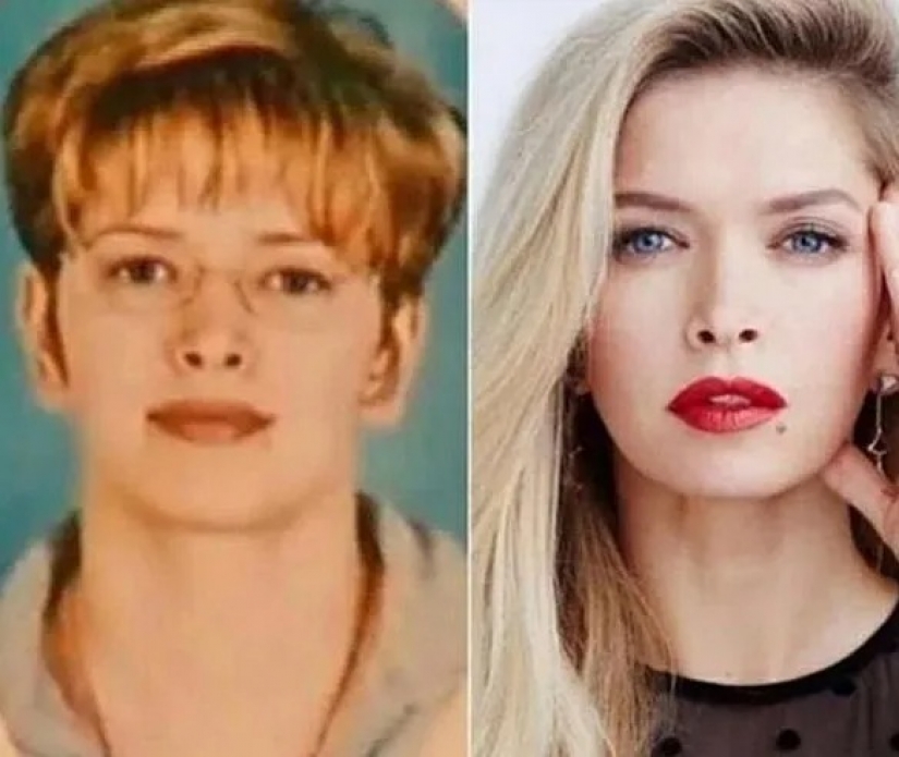 Valeria, Anastasia Zavorotnyuk and 8 other stars who proved that they did not do plastic surgery Valeria, Anastasia Zavorotnyuk and 8 other stars who proved that they did not do plastic surgery