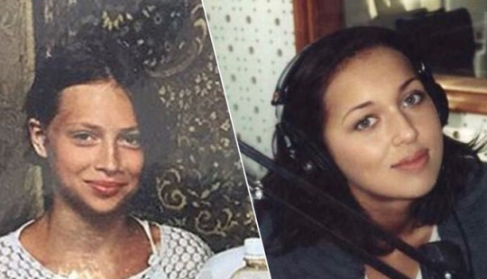 Valeria, Anastasia Zavorotnyuk and 8 other stars who proved that they did not do plastic surgery