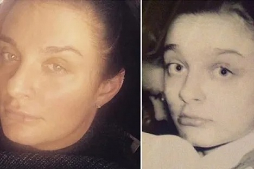 Valeria, Anastasia Zavorotnyuk and 8 other stars who proved that they did not do plastic surgery Valeria, Anastasia Zavorotnyuk and 8 other stars who proved that they did not do plastic surgery