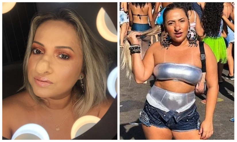 "Vaya, Pinocho!": una mujer brasileña ha aprendido a amarse a sí misma, a pesar de una nariz enorme