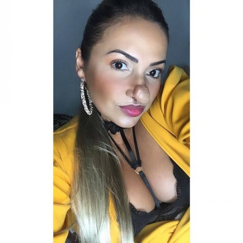 "Vaya, Pinocho!": una mujer brasileña ha aprendido a amarse a sí misma, a pesar de una nariz enorme