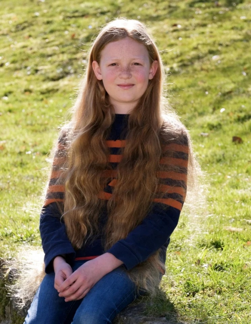 Why did this 12-year-old boy grow such long hair