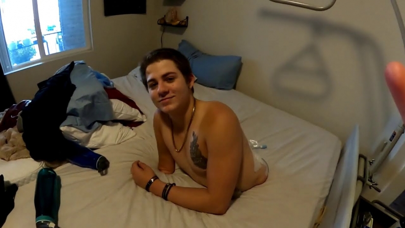 Winner of Death: how a 19-year-old American lives after a lower-body amputation Winner of Death: how a 19-year-old American lives after a lower-body amputation