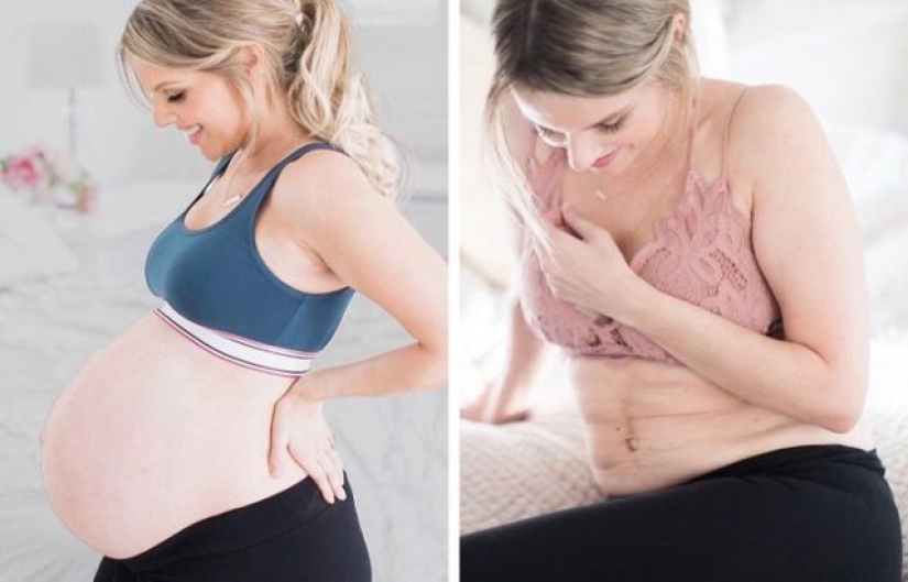 10 Celeb Moms Who Proudly Shared Their Postpartum Body With The World 10 Celeb Moms Who Proudly Shared Their Postpartum Body With The World