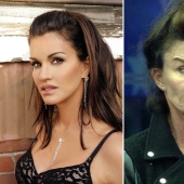 10 celebrities who strongly regretted plastic surgery