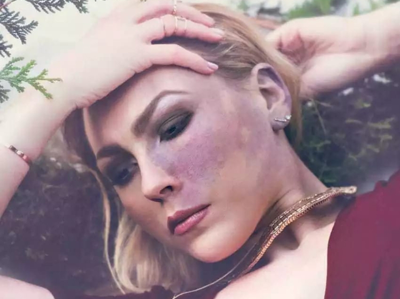 10 chicas que convirtieron sus defectos en fortalezas