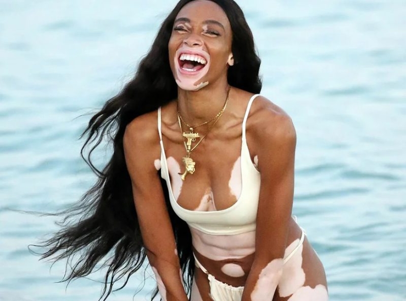 10 chicas que convirtieron sus defectos en fortalezas