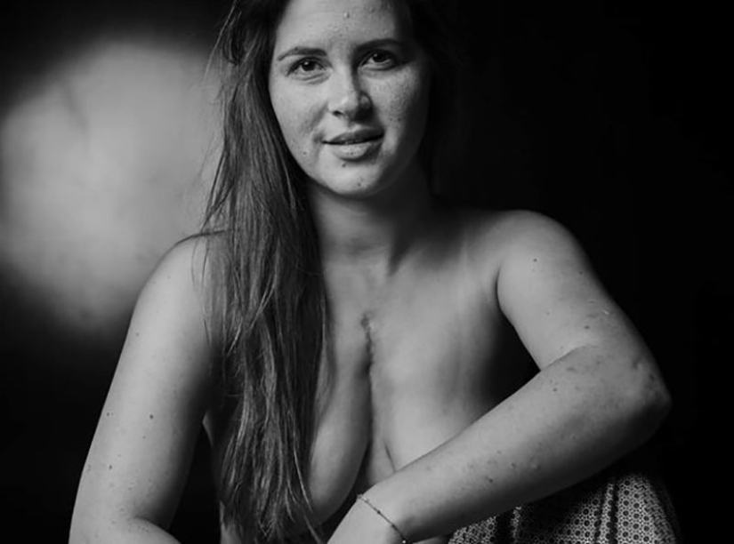 10 chicas que convirtieron sus defectos en fortalezas