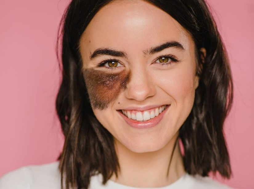 10 chicas que convirtieron sus defectos en fortalezas