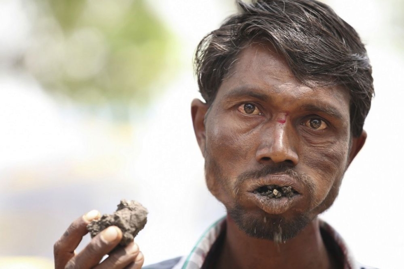 10 condiciones médicas extrañas de las que casi nadie ha oído hablar