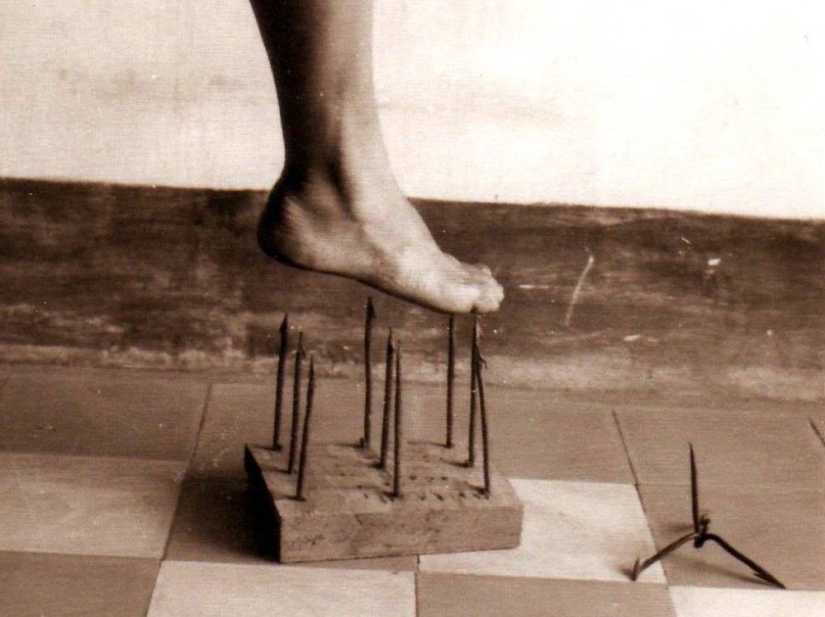 10 condiciones médicas extrañas de las que casi nadie ha oído hablar