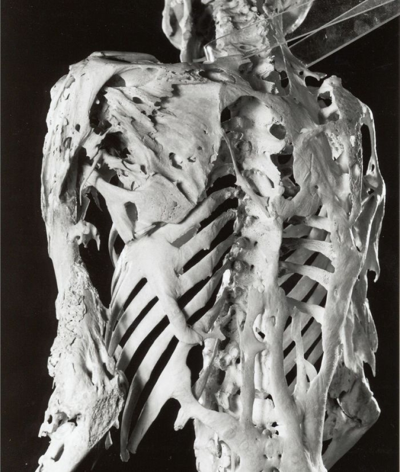 10 condiciones médicas extrañas de las que casi nadie ha oído hablar