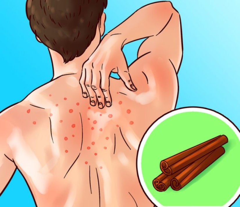 10 especias y hierbas que cuidan tu cuerpo de pies a cabeza